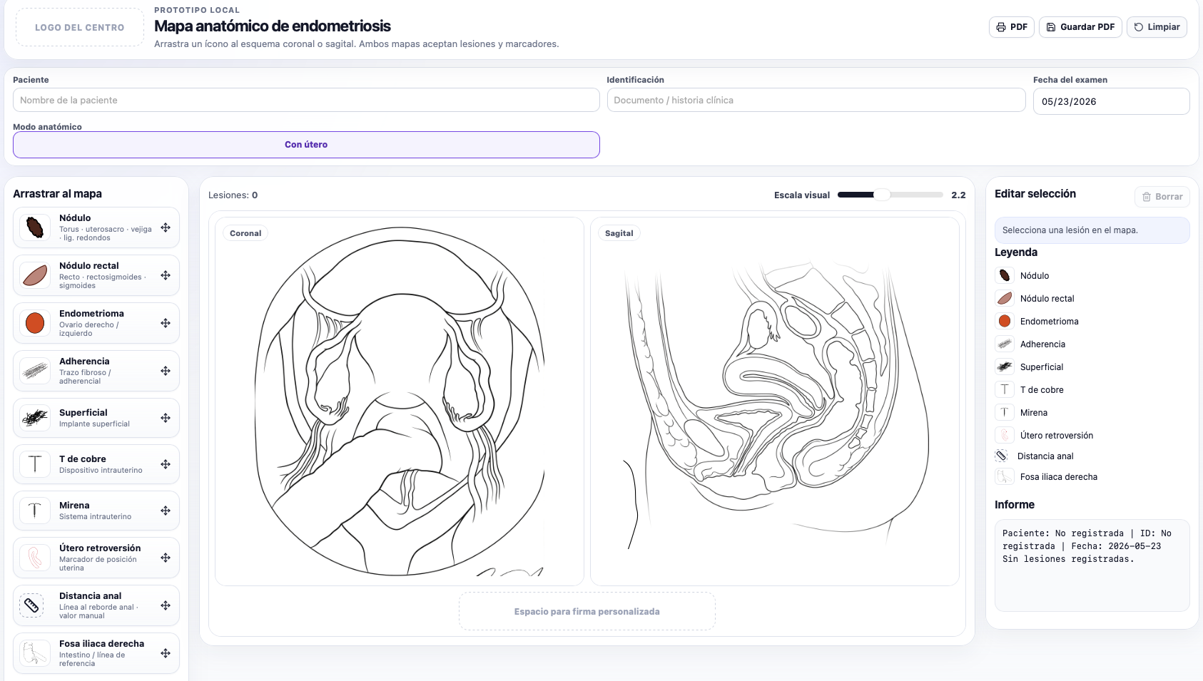 Captura de pantalla de Endometriosis Map con esquemas coronal y sagital